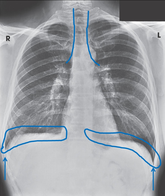 Radiographer at Imperial College Healthcare NHS Trust, London