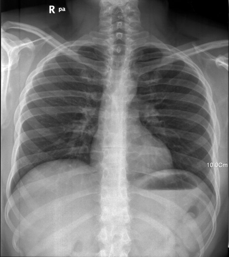 Diagnostic Radiographer at North Cumbria Integrated Care NHS Foundation Trust, Whitehaven